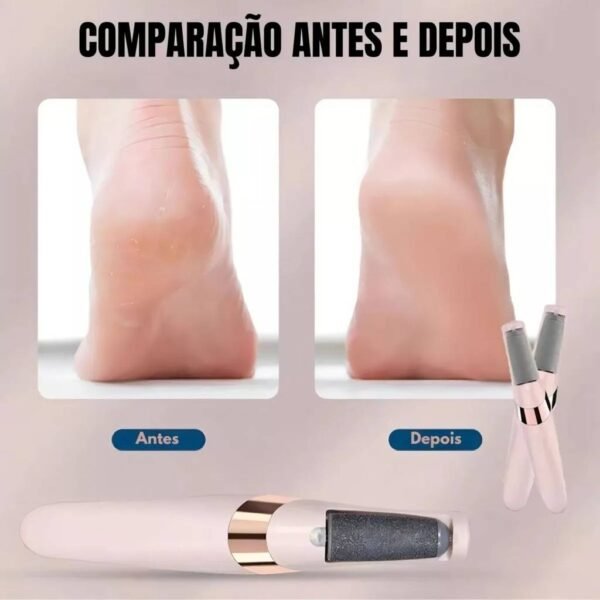 Lixador Para Pés Elétrico - Removedor de Calos e Rachaduras Portátil e Recarregável - Imagem 4